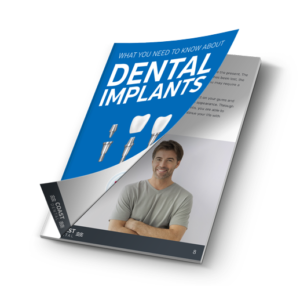 Coast Dental's dental implant guide