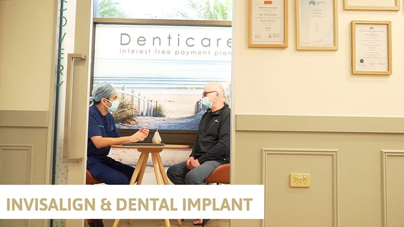 dental implant