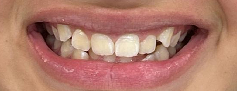 Before
